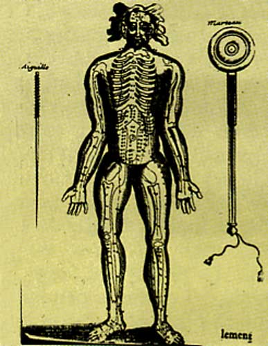 La plancha de acupuntura más antigua que se conserva. Datada en 1684. Representa a un hombre y una aguja.